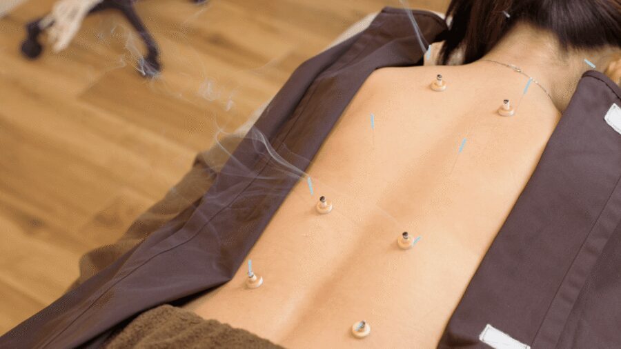 Hiroshima: Acupuncture and Japanese unique massage treatment - Private room care: what “one-on-one” really changes